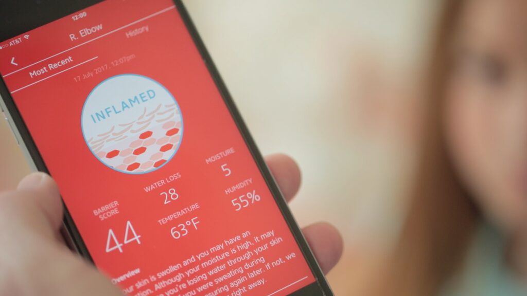 **Alt Text:** A smartphone screen displays an app with a red background indicating skin inflammation with metrics like barrier score, water loss, moisture, temperature, and humidity.